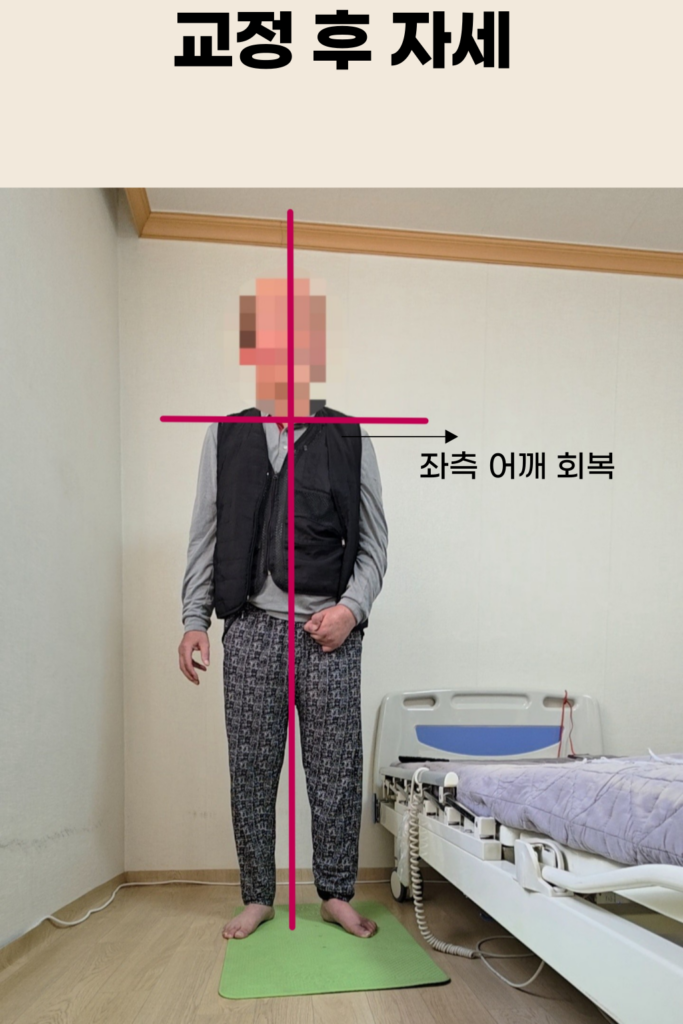뇌혈관질환 재활 교정 장면
