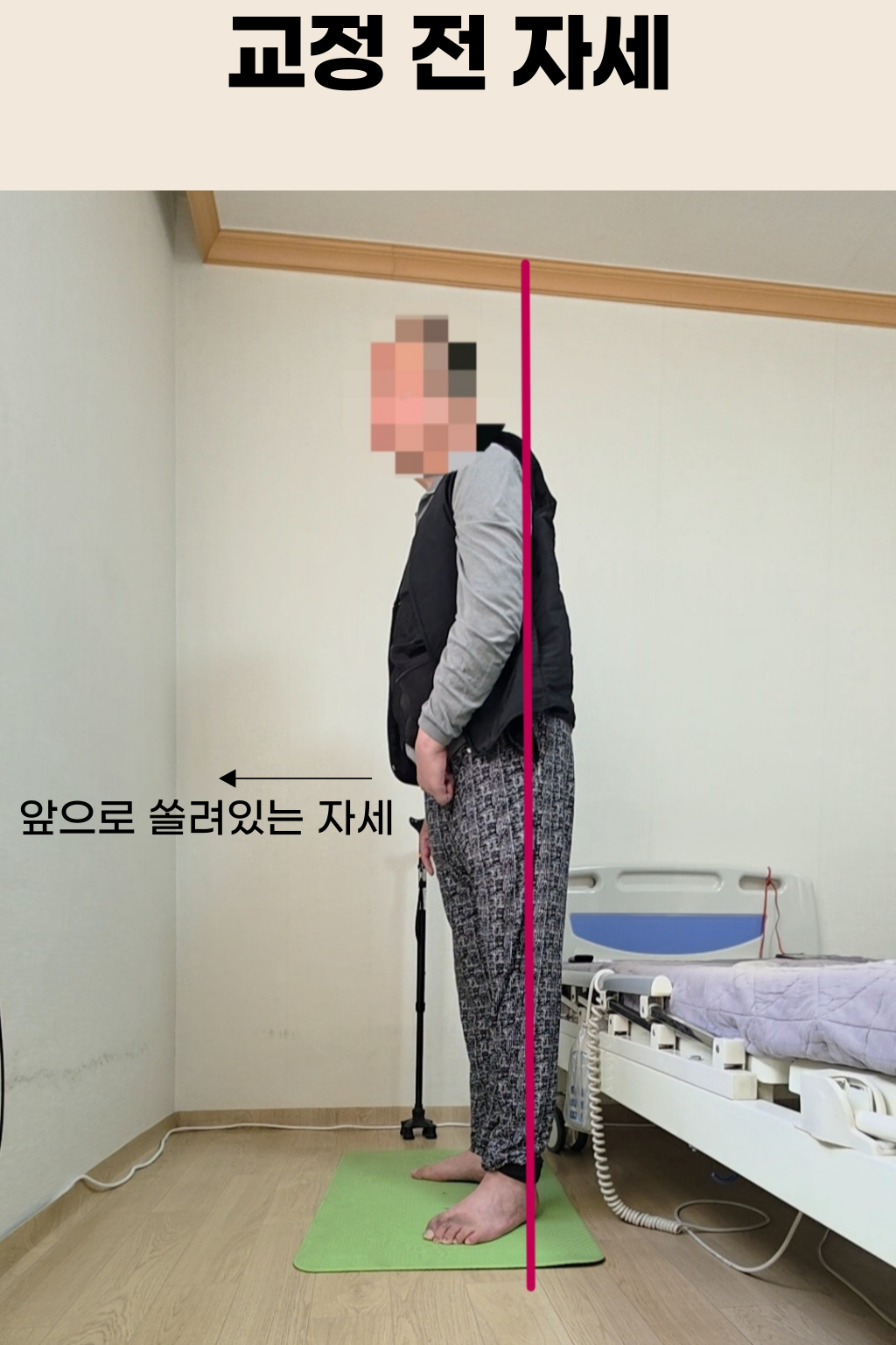 뇌혈관질환 재활 사례