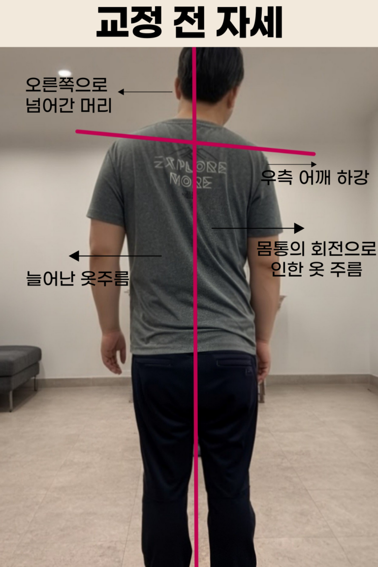 교정전자세